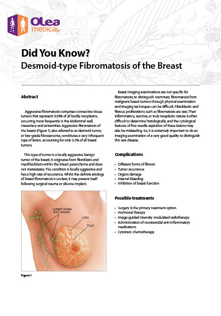 Desmoid-type Fibromatosis of the Breast